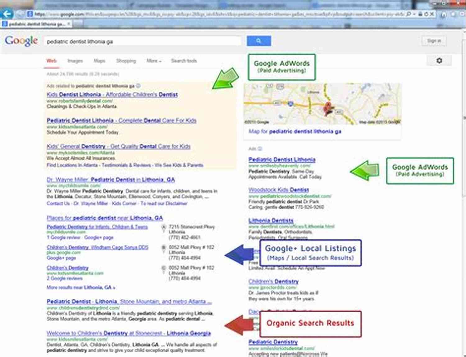 Get Your Website Listing Well In Search Engine Results Simply And Easily Easy SEO EASY: Get Your Website Listing Well In Search Engine Results Simply And Easily Easy Step By Step Guide To Get Your Website To The Top